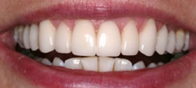 Catherine Maltby After