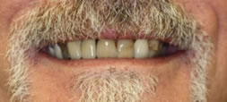 David Before