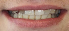 Before