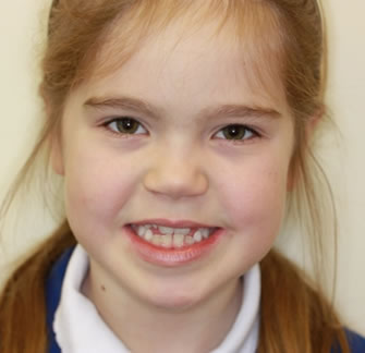 Before cosmetic dentistry