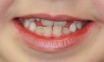 Before cosmetic dentistry