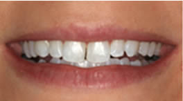 Catherine Maltby Before