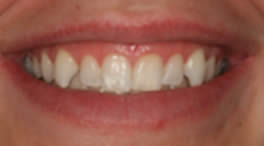 Catherine Maltby Before