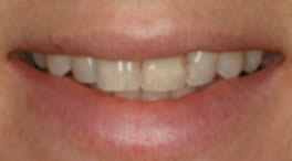 Catherine Maltby Before