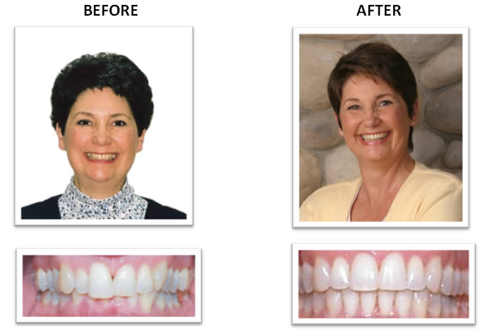 Damon braces case 1 in Birmingham