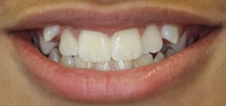 Catherine Maltby Before